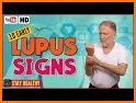 Lupus: Causes, Diagnosis, and Treatment related image