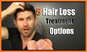 Treatment of hair loss related image