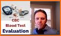 Blood Test Guide, Blood Test Result Pathology Test related image