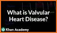 Valvular Heart Disease related image