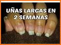 Como Hacer Crecer Las Uñas related image