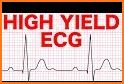 The ECG Made Easy, 8e related image