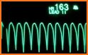 ECG Rhythm and Pulse related image