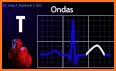 Electrocardiograma ECG Tipos related image