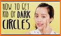 Get Rid Of Dark Circles Under Eyes related image