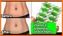 Get Rid of Body Stretch Marks related image