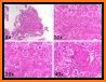 Pathology Review Quiz related image