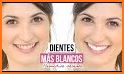 Tips Dientes Blancos related image