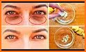 Get Rid Of Dark Circles Under Eyes related image