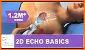 ECHOCARDIOGRAPHY GUIDE related image