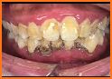 Pet Dentist Teeth Bling related image