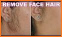 Get Rid Of Facial Hair Naturally related image