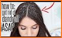 Get Rid of Dandruff related image