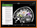 Medical Atlas - Medical Imaging & Radiology Tool related image