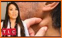 Zit Popper - New Doctor Pimple Pop related image