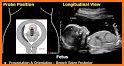 Obstetrics & Gyenacology Ultrasound Guide related image