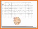 EEG 101 related image