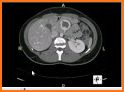 CT Scan Cross Sectional Anatomy related image