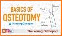 Basics of Orthopaedics related image