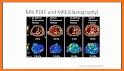 NAFLD Calc related image