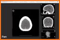 Interactive CT and MRI Anatomy related image