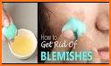 Face Blemishes Removal related image