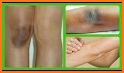 Get Rid Of Dark Knees And Elbows Fast & Naturally related image