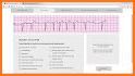 ACLS QUIZ 2019 related image