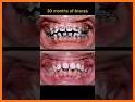 Dentist & Braces doctor - Mouth care surgery related image