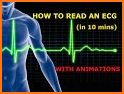 ECG Master: Electrocardiogram Quiz & Practice related image