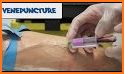 Proper Venipuncture related image