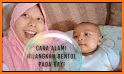 tips simpel cara menghilangkan bentol pada bayi related image