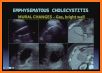 ULTRASOUND GALLBLADDER AND PHATOLOGY related image