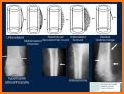 Musculoskeletal X- Rays Interpretation related image