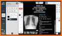 RadMax - Radiography Guide related image