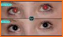 Red Eye Corrector & Remover AI related image