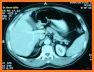 CT Passport Chest / sectional anatomy / MRI related image