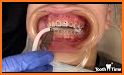 Funny Teeth kid dentist care! Games for boys girls related image