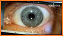 Iridology Unlocker related image