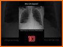 XRay Scanner for Body Quiz related image