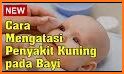 tips sehat dan mudah mencegah sakit mata pada bayi related image