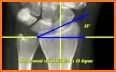 Radiology Measurements related image