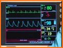 iBP Blood Pressure related image