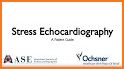 ECHOCARDIOGRAPHY GUIDE related image