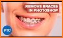 Braces Photo Editor Free related image