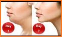 Chubby Cheeks Exercises - Lose Facial Fat Fast related image