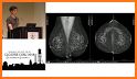 Dicom Medical Image Viewer related image