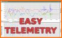 Accelerometer Plotter related image