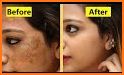 Face Beauty related image