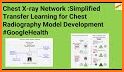 Chest X-Ray Classifier related image